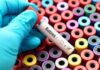 A hand in a blue glove holding a blood test tube labeled Rabies over colorful sample containers