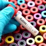 A hand in a blue glove holding a blood test tube labeled Rabies over colorful sample containers