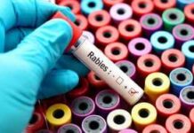 Puppy Scratch Killed Her With Rabies A hand in a blue glove holding a blood test tube labeled Rabies over colorful sample containers