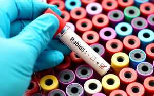 A hand in a blue glove holding a blood test tube labeled Rabies over colorful sample containers